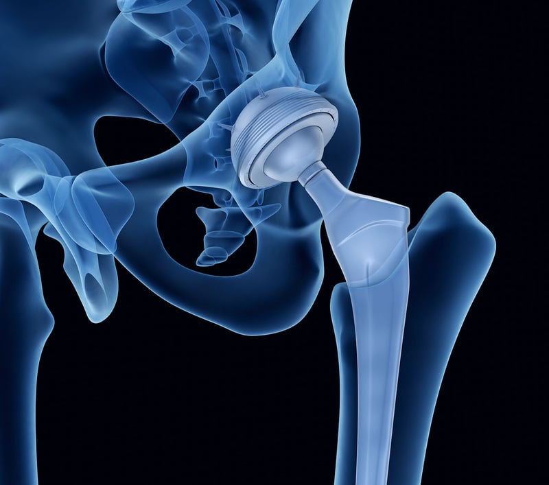 Biomaterials & medical device research Top 5 Sensors